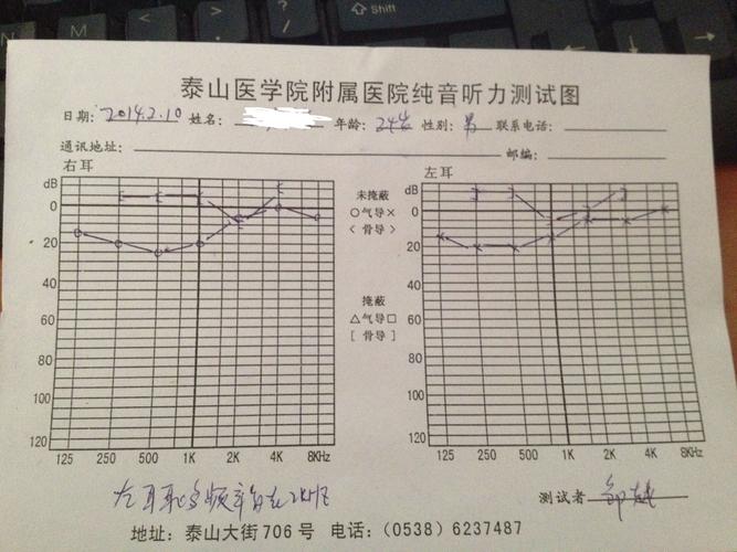 耳鼻喉纯音阻抗检测