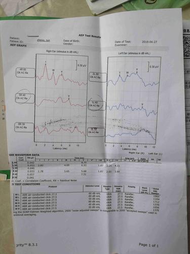 稳态听觉检测听诊断报告