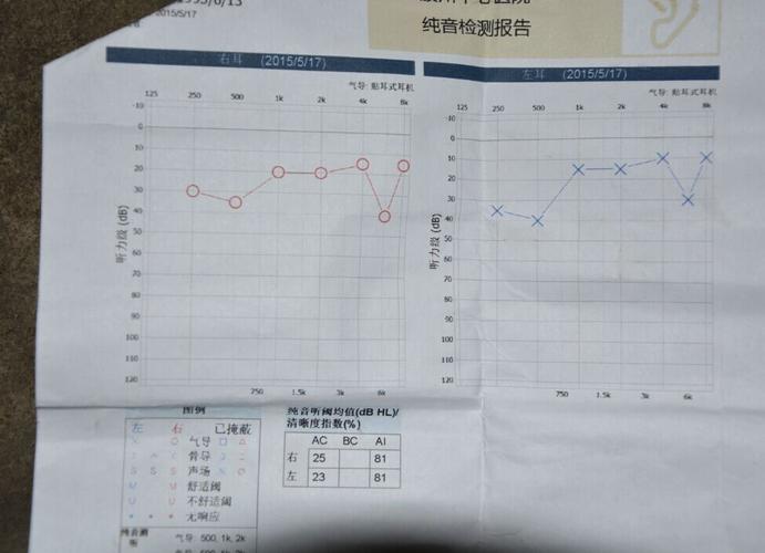 稳态听觉检测听诊断报告