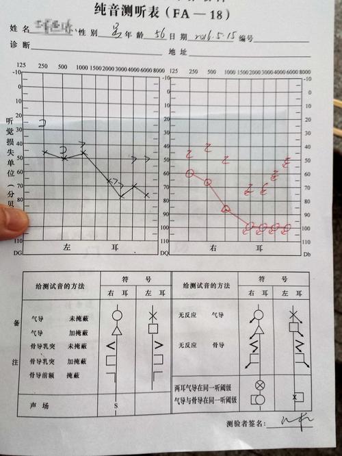 在体检过程中，纯音听力检查是评估个体听力水平的重要手段之一。此项测试能有效测定个体对于不同频率声音的最小可听限度，即听阈。在此，我们将深入探讨纯音听力测试的窍门以及如何正确理解测试结果。以下是具体内容