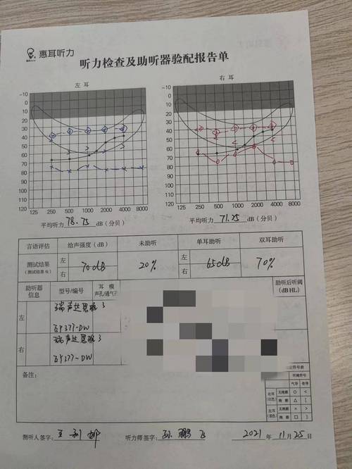 在体检过程中，纯音听力检查是评估个体听力水平的重要手段之一。此项测试能有效测定个体对于不同频率声音的最小可听限度，即听阈。在此，我们将深入探讨纯音听力测试的窍门以及如何正确理解测试结果。以下是具体内容