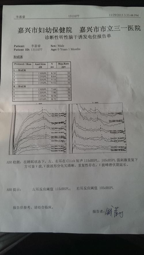 ABR常用于哪些听障者的检测