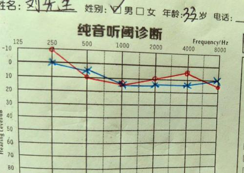 听力检测是评估个体听力水平的重要手段，听力图中的X和O是解读听力测试结果的关键符号。在听力学领域，对这些符号的正确理解至关重要，因为它们直接关联到听力损失的诊断和治疗。本文将详细解释这些符号的含义及其在听力评估中的应用。