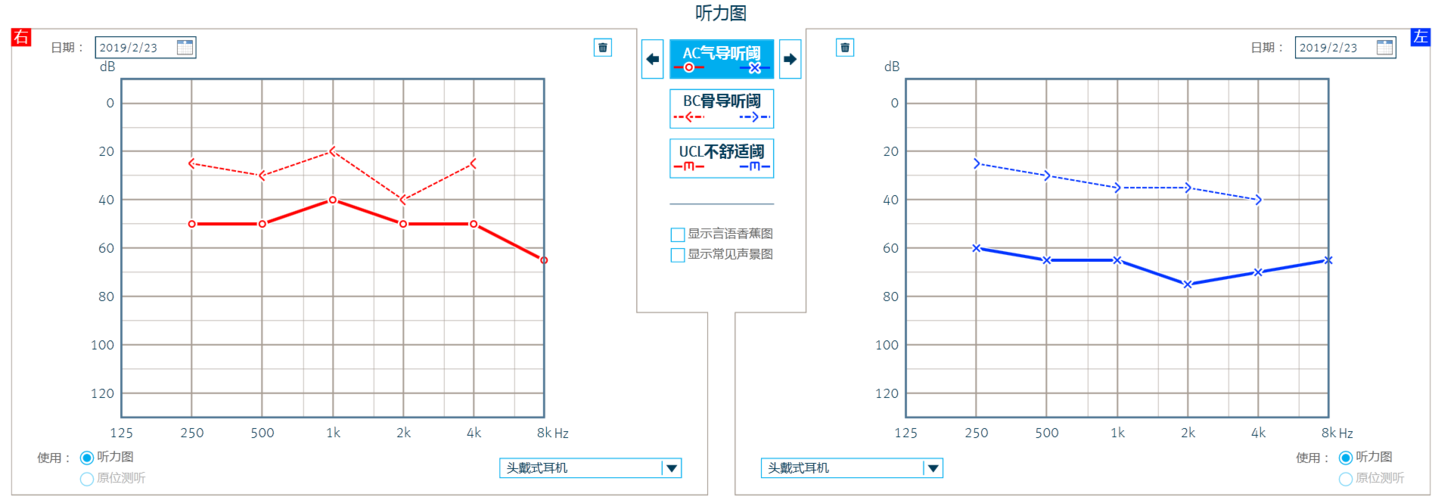 听力检测是评估个体听力水平的重要手段，听力图中的X和O是解读听力测试结果的关键符号。在听力学领域，对这些符号的正确理解至关重要，因为它们直接关联到听力损失的诊断和治疗。本文将详细解释这些符号的含义及其在听力评估中的应用。