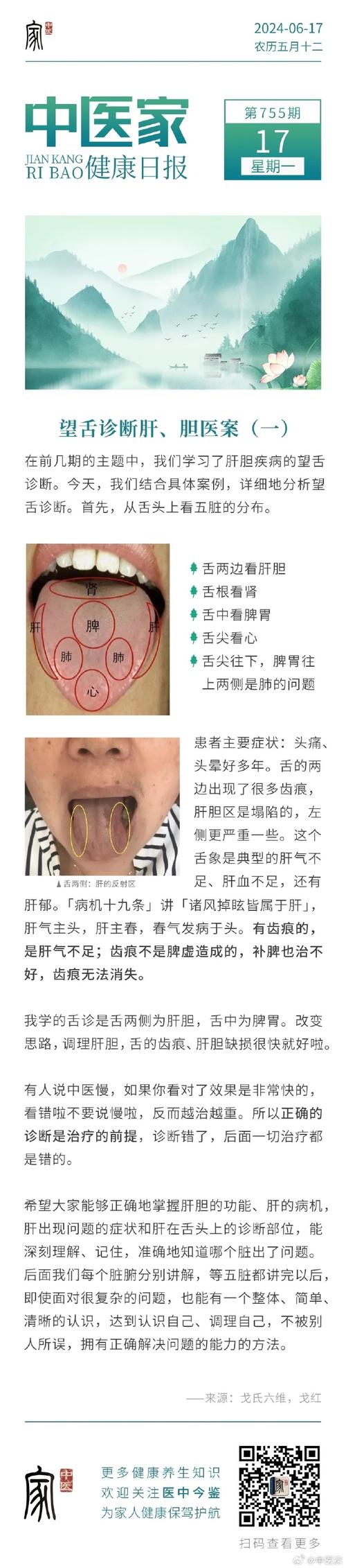 详细内容如下